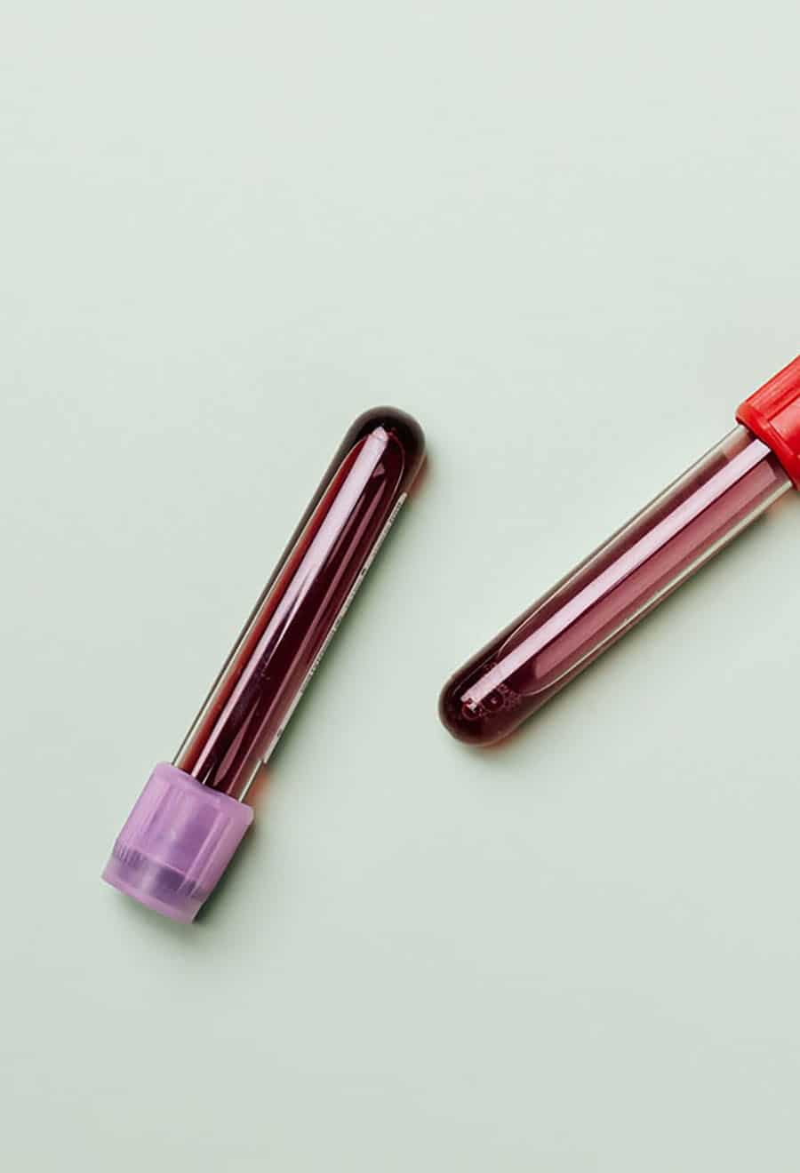 CoverImage-BloodVials